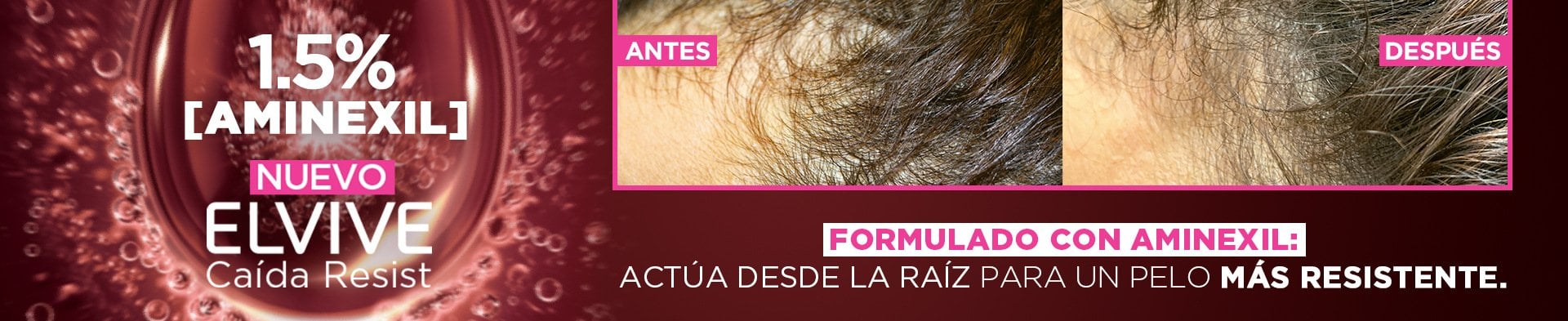 Antes y después del Nuevo Elvive Caída Resist con 1.5% de aminexil.